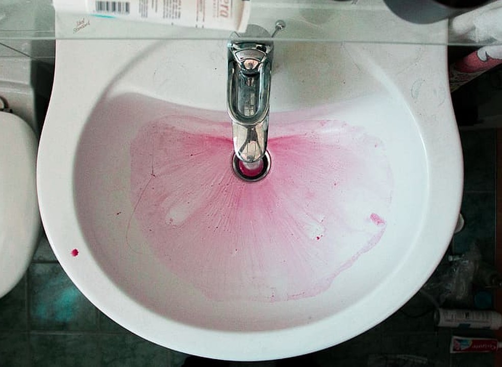 Elementos rosados grudados no banheiro não são mofo, e, sim, a bactéria Serratia — Foto: Wallpaper Flare / Creative Commons
